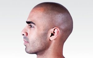 Is SMP® Scalp Micropigmentation For Me?