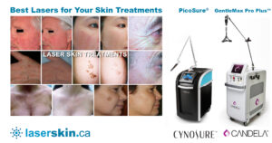 laser skin treatments header image