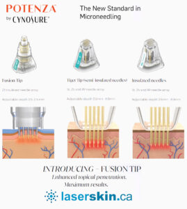 microneedling vs rf microneedling Toronto Canada