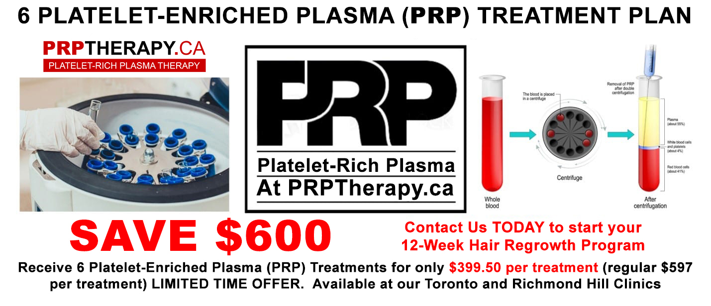 PRP hair treatment cost Toronto