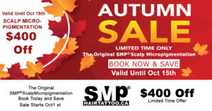 SMP scalp micropigmentation Toronto