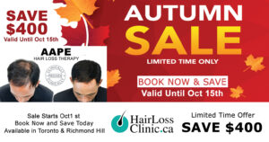hair loss treatment - Hair Loss Clinic Toronto