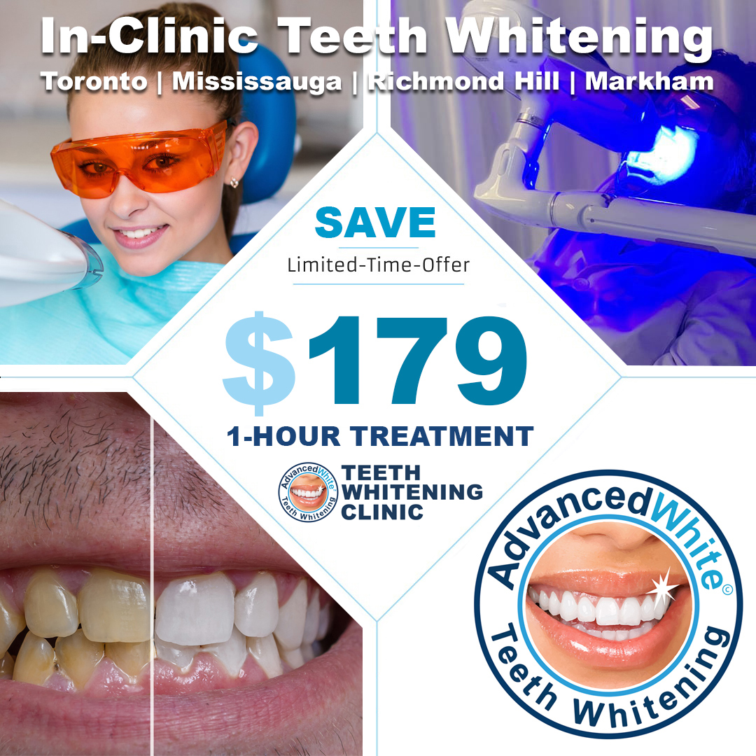 teeth-whitening-services
